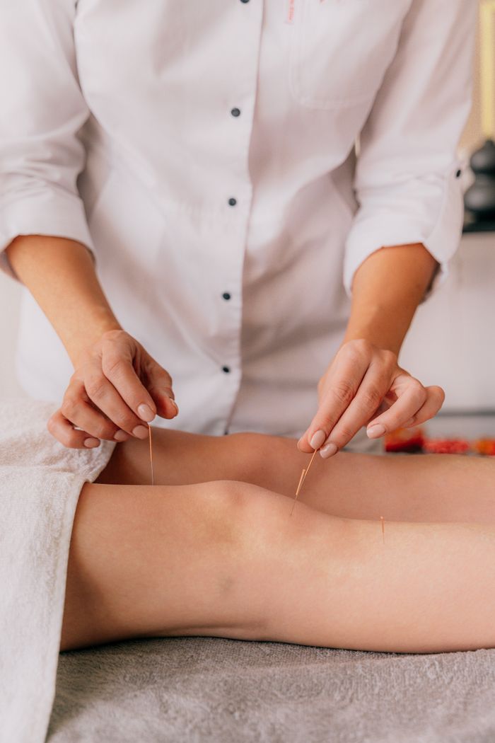 Close-up of professional performing acupuncture on a client's knee indoors.